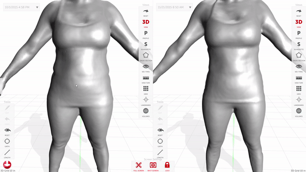Styku 3D Body Scan