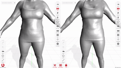 Styku 3D Body Scan