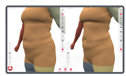 Styku 3D Body Scan